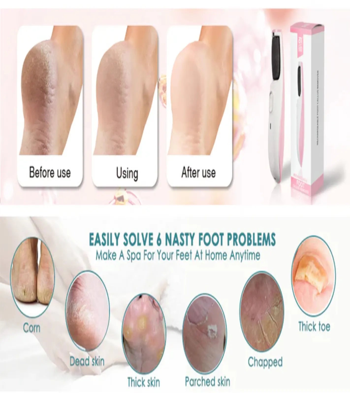 Before and after results of electric foot callus remover for dead skin and cracked heels